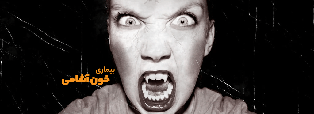 پرونده کودتای خزنده (طرح صیانت) 57 سندروم رنفیلد یا بیماری خونآشامی